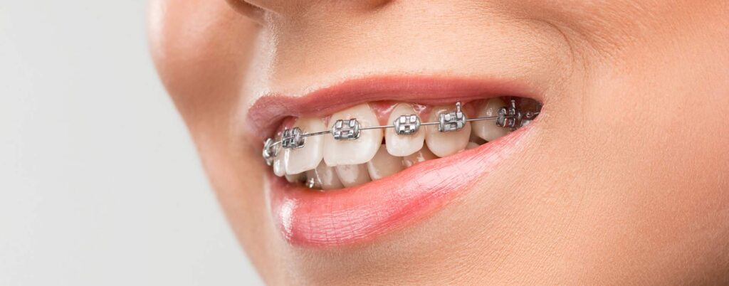 Orthodontics e1668981107468